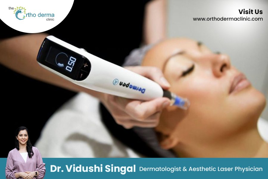 Discover the Power of Dermapen 4 Treatment at Orthoderma Clinic