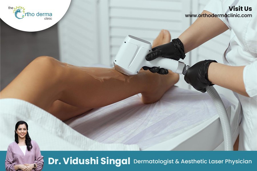 Get Summer-Ready with Laser Hair Reduction