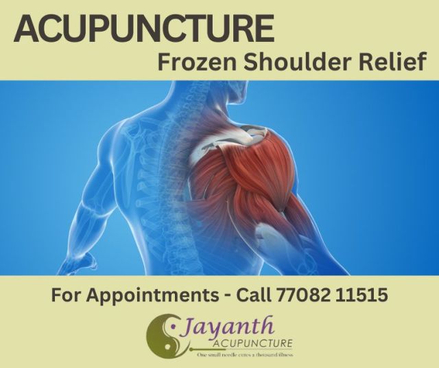 The Best Acupuncture Treatment in Chennai | Acupuncturist Near You | DoctorBest Acupuncture Treatment by Well Experienced Acupuncture Doctor in Chennai | Jayanth Acupuncture Clinic | Certified Zhu's Scalp Acupuncturist | IVF IUI Support Fertility Acupuncture
