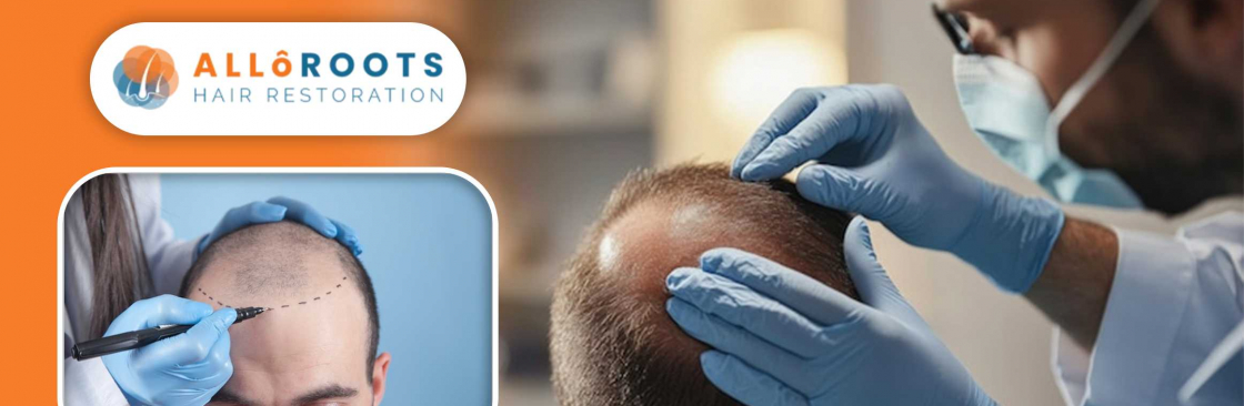 Alloroots Hair Restoration Cover Image